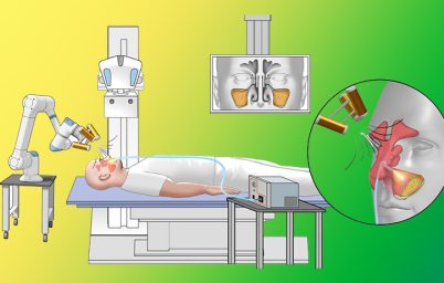 mikro-robotlar-tedavi-ediyor