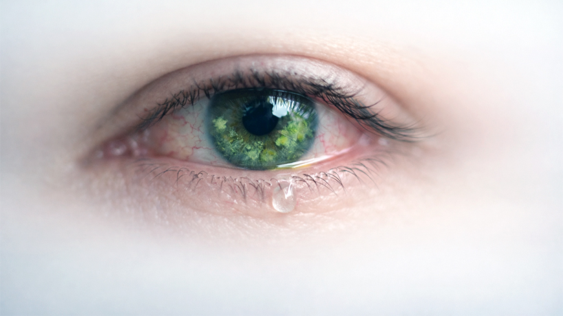 kuru-goz-otoimmun-hastaliklarin-erken-sinyali