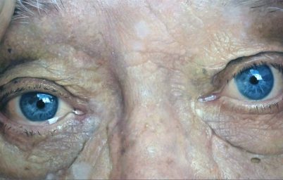 genetik-kodla-genclik-arayisi